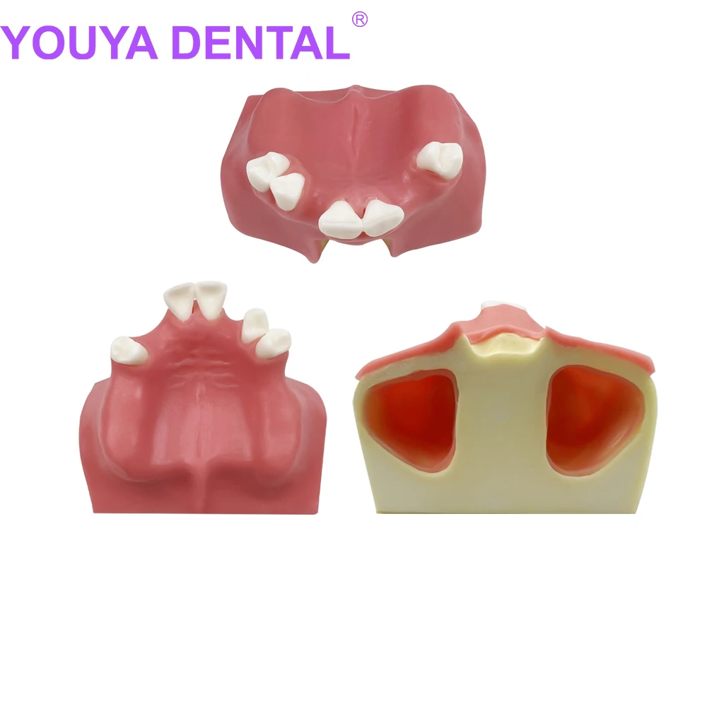 

Dental Implant Practice Model Maxillary Sinus Teeth Model For Studying Training Dentistry Student Education Demonstration Tools