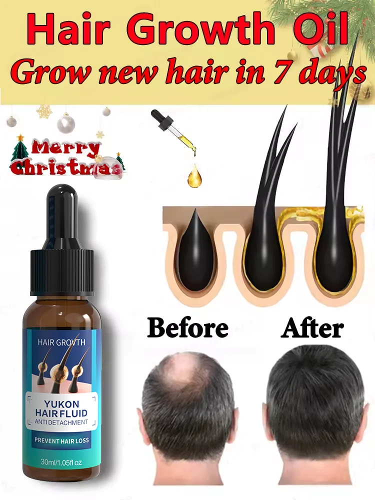 Hot sale, buyers will buy again, hair is getting more and more, say goodbye to baldness, sparse hair starts to become thick