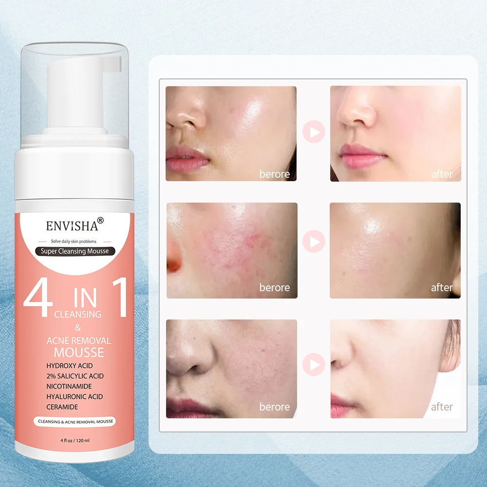 ENVISHA Gesichts Hautpflege Pe – Salicylic Acid Cleanser Bewertung und Preis