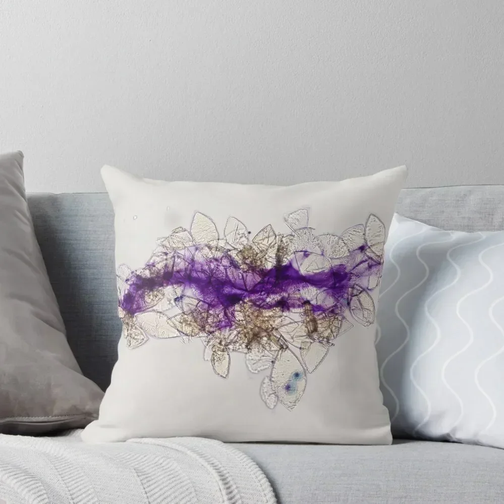 

Urate crystals mimicking Schistosoma eggs Throw Pillow New year Elastic Cover For Sofa luxury covers pillow