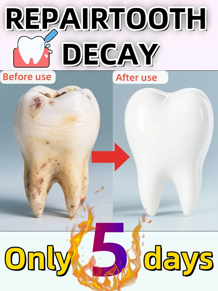 

Удаление зубного камня, растворение зубного камня и удаление пятен