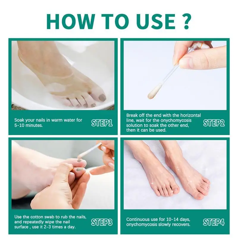 Reparação Essência Nail Tratamento Soro, Toe Nails Remoção Gel, Anti Onicomicose Cotonete, Cuidados com os pés