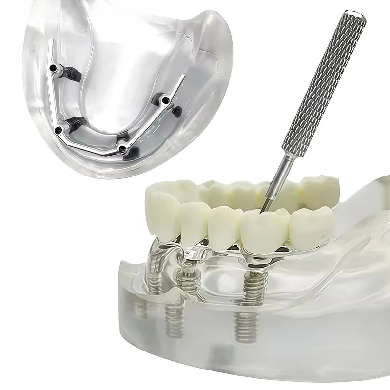 Dental Implant Model, Implant Restoration, Realistic Demonstration and Simulation for Teaching Four Dental Implants in The Mouth