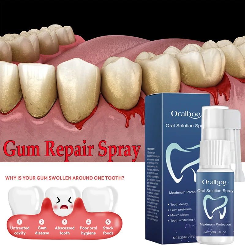 Repair Gums Serum Spray Effectively Relieve Tooth Allergy Dental Caries Tooth Cleaning Toothpaste Relieve Tooth Damage Serum