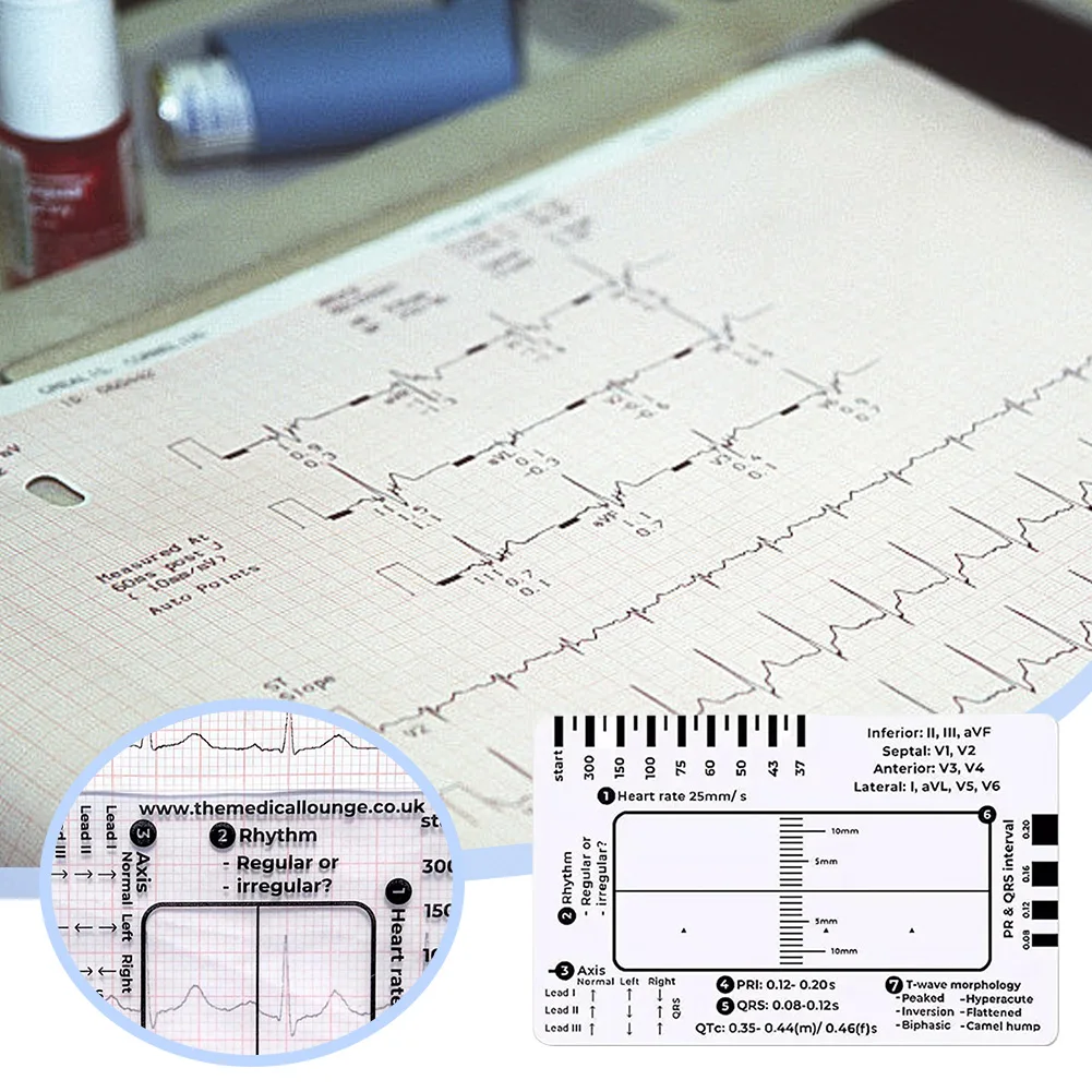 Ecg Regla de 7 pasos Ecg/ekg Tarjeta de regla de 7 pasos, calibrador portátil de bolsillo Ecg Ekg con herramienta de evaluación de funda protectora