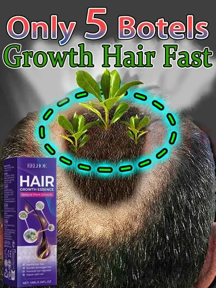 Hair Growth Essential Loss Regrowth Treatment Strengthens Hair Nourishes Scalp Light Weight Non Greasy Improve Scalp Circulation