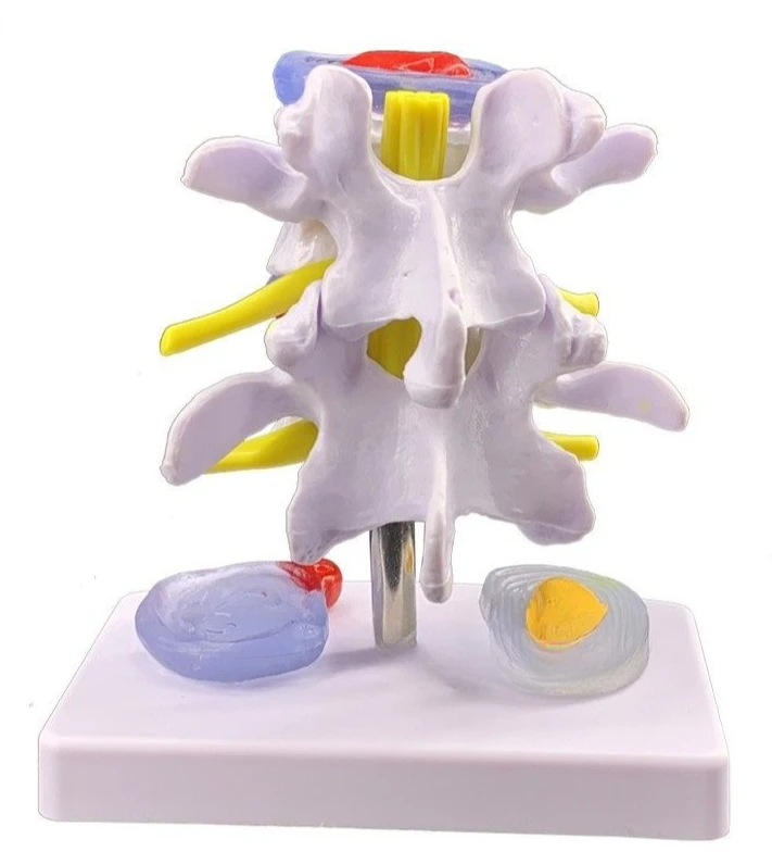 Disc herniation model Bone pathology model