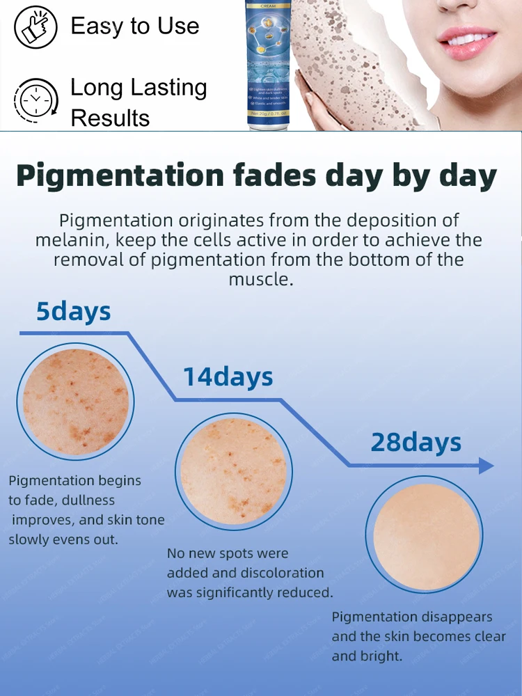 Soins de la peau du visage, élimination des taches de rousseur et des taches foncées