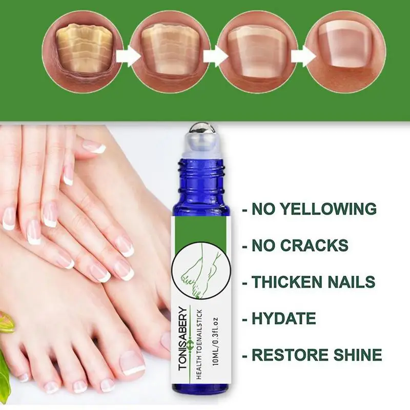 Roll On Cuticle Oil Toenail Renewal Solution 0.3fl Oz Natural Soothing Softening Healthy Cuticle Oil Rollerball Strengthens