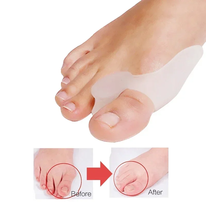 2Pcs Silicone Special  Protector Bone Thumb Orthotics Braces Corrector Soft Silicone Foot Big Toe Separator Pedicure