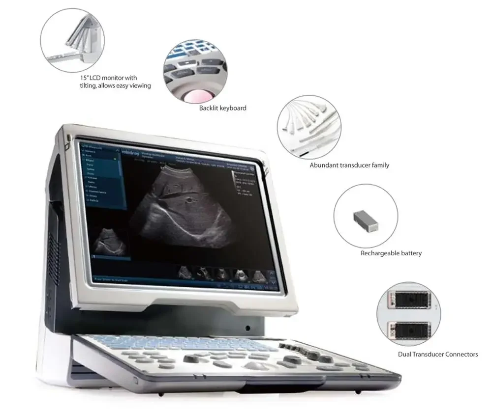 Mindray DP-50 ultrasound machine (with a convex probes)