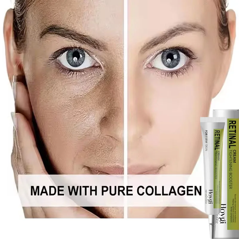 

Retinol Cream Anti Wrinkle Tightening Improve Sagging Smoothing Moisturizing Lightening Firming Radiant Fine Lines Removal Cream