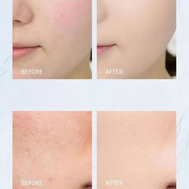 얼굴 및 눈용 뷰티 케어 도구 스테인리스 스틸 페이스 뷰티 크라이오 스틱 남녀용 얼굴 마사지 쿨링 스파 글로브