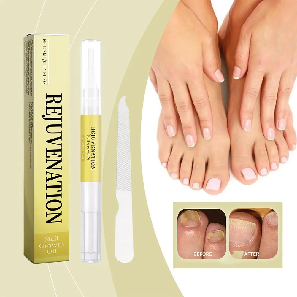 Loción reparadora de uñas con lima de uñas, crema protectora para pies, productos de reparación de aceite y reparación fuerte, cuidado de uñas suave Na R2X9, 2ml