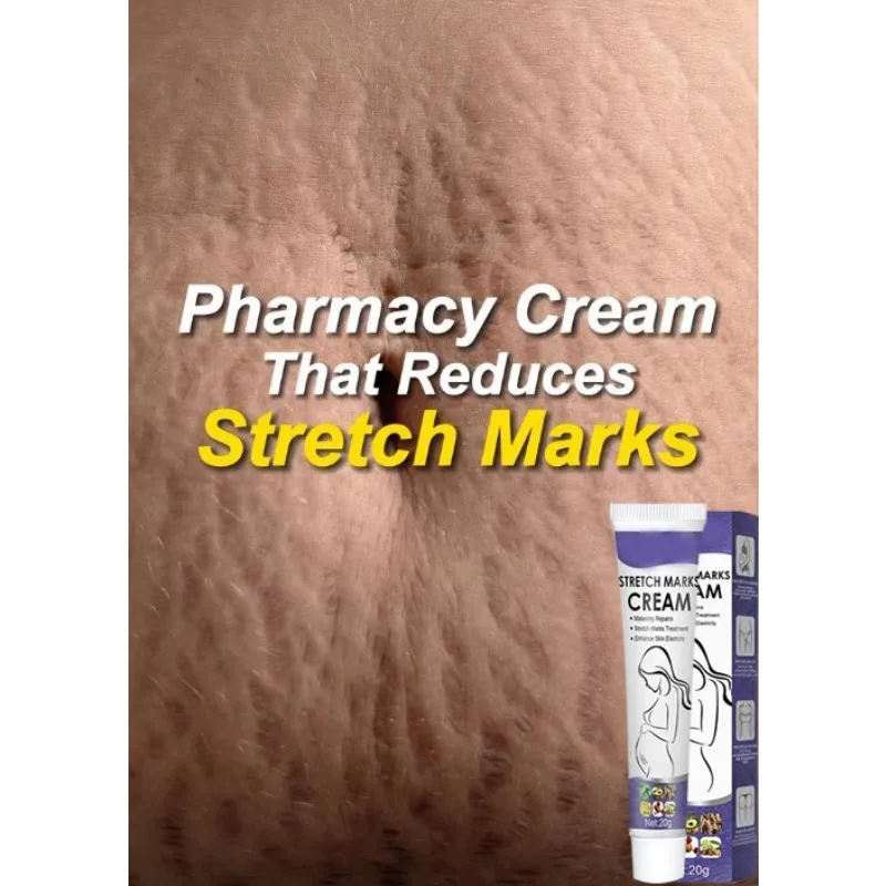 

Skin Care Improves Elasticity Effective After Pregnancy Stretch Marks Removal Powerful Maternity Cream Nourishes Skin