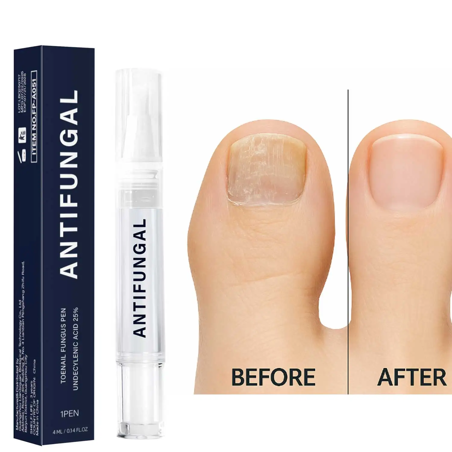 Zehennagelpilzstift UNDECYLENIC ACID 25 % – Heilt den Fuß des Fußes von Athleten, Jock Itch und Ringworm. Keine Feilen erforderlich. 4 ml Reisegröße
