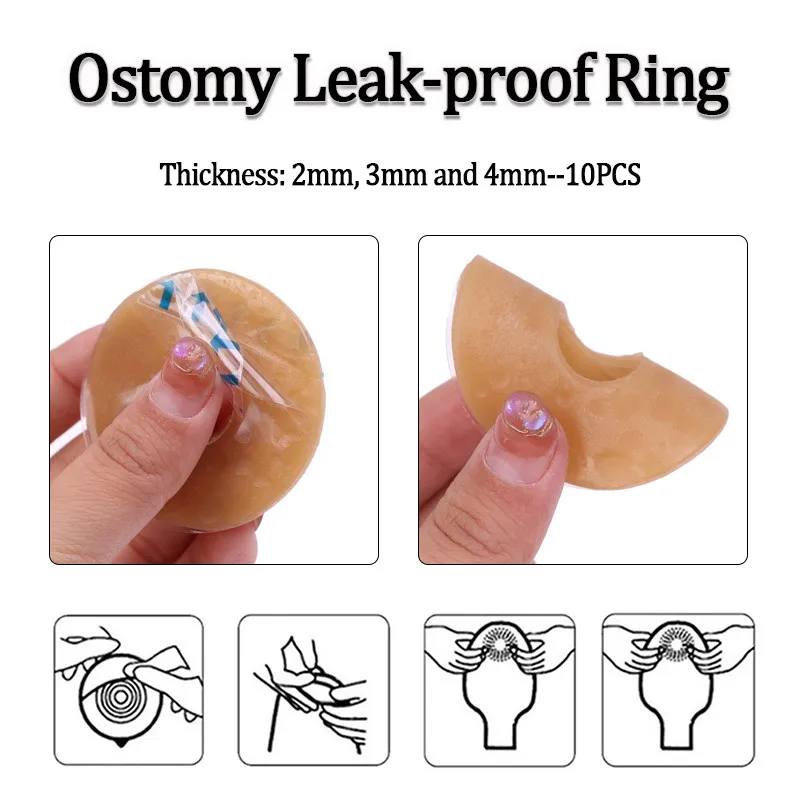

Набор из 10 герметичных патчей для стомы, защищающих кожу, формирующих контур, кольца для стомы, предотвращающие протекание, 2/3/4 мм