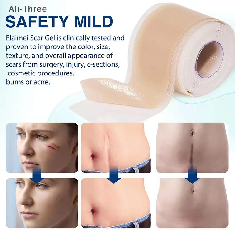 

1 Roll Silicone Scar Sheets Skin Repair Patch Removal Self-Adhesive Stretch Mark Tape Therapy Patch Burn Acne Scar Skin Care