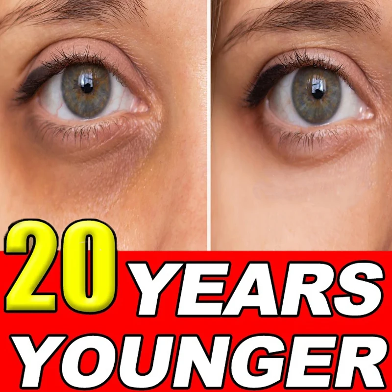 

Help you have a pair of beautiful eyes
