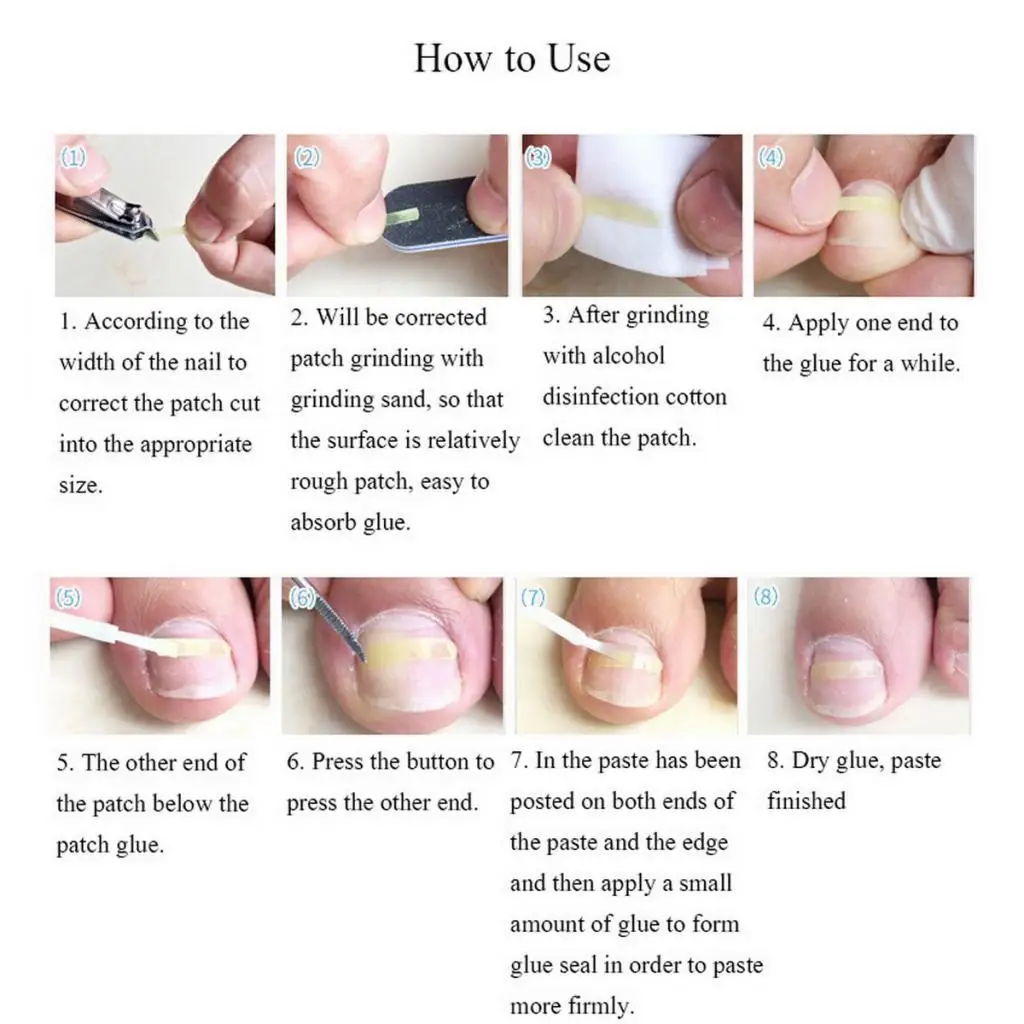 Nail Art Adhesive Correction Sticker Ingrown Toenail Orthotic Nail Design for Pedicure Tool Kit