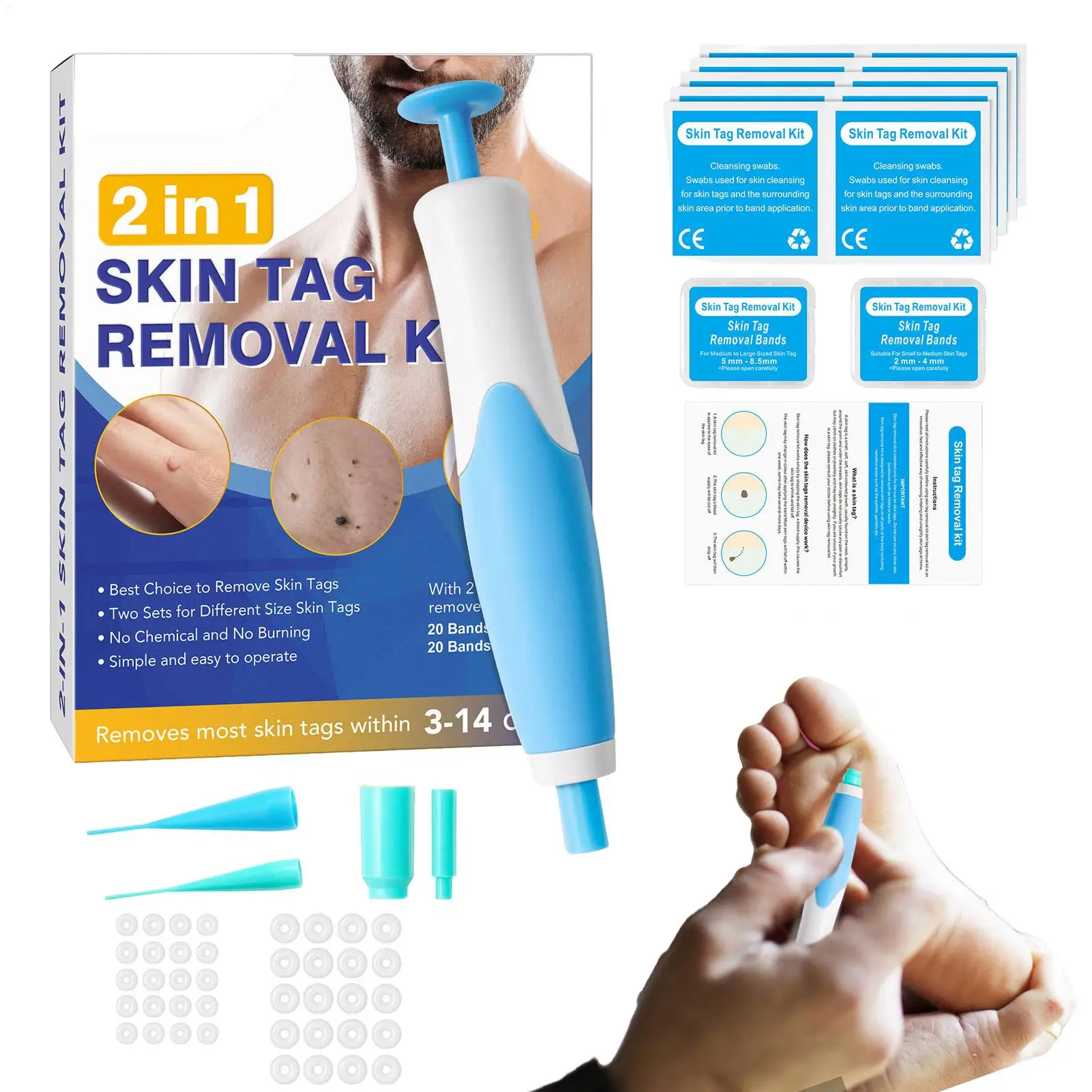 Verbesserte Haut Tag Entferner Stift Haut Tags & Maulwürfe Entfernung Kit schmerzlos und sicher entfernen kleine bis große Größe 2mm bis 8mm Haut Tag