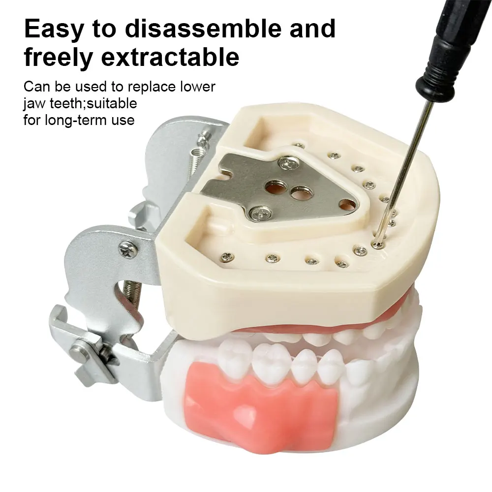 28 Teeth Dental Abscess Model Abscess Incision Drainage Lump Removable Soft Silicone Dental Doctor-Patient Oral Teaching Model