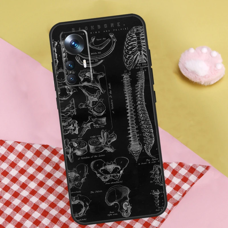 Radiological Human Organs Skeleton Case For Xiaomi 13 13T Pro 12T 11T 12 Lite 12X POCO X3 X5 Pro X4 F4 GT M5 M5s F3 F5 Funda