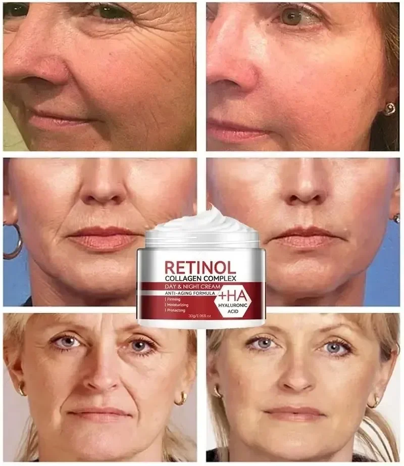 Retinol Rimpel Verwijderen Crème Anti Veroudering Verstevigende Lifting Vervagen Fijne Lijntjes Whitening Hydraterende Huidverzorging Cosmetica