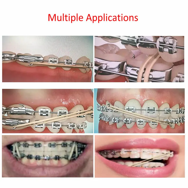 100 Teile/beutel Dental Gummibänder Gummibänder Kieferorthopädische Latex Hosenträger Ungiftige Materialien 3,5 UNZEN/5 UNZEN/6,5 UNZEN – Detail 2