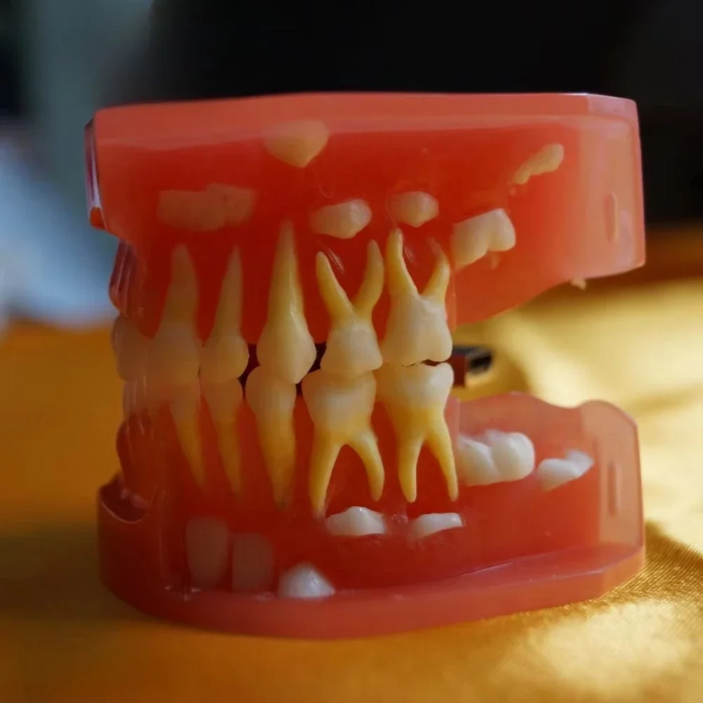 3-Year-old dentals model Human dentals model Medical science education model