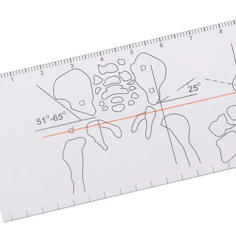 Multi-Ruler Goniometer Angle Medical Ruler Joint Orthopedics Tool Instruments