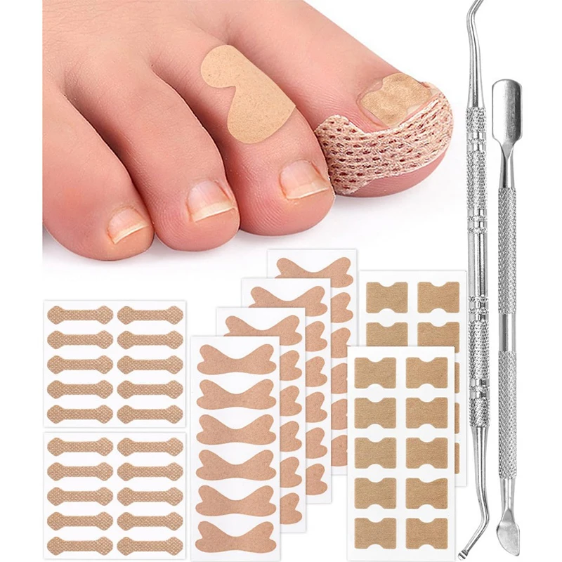 10Pcs Ingrown Toenail Correction Sticker Set Adhesive Toenail Patch Elastic Nail Treatment Corrector Sticker Foot Care Tools