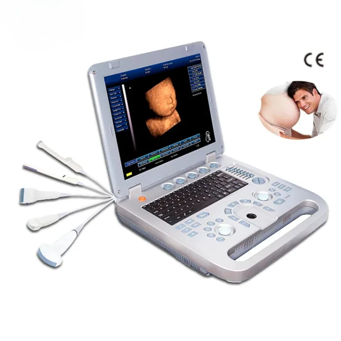 

BW Portable Ultrasonics Machine Basic Laptop 3D BW Ultrasound Scanner Machines