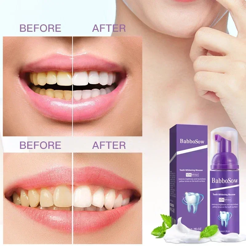 

Heallor New 50ml Toothpaste Mousse V34 Teeth Cleaning Whitening Toothpaste Yellow Teeth Removing Tooth Stains Oral Cleaning Hygi