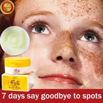 Astragalus clareamento sardas creme facial remover manchas escuras melasma clarear melanina cicatrizes de acne anti-envelhecimento iluminar cuidados com a pele 50g