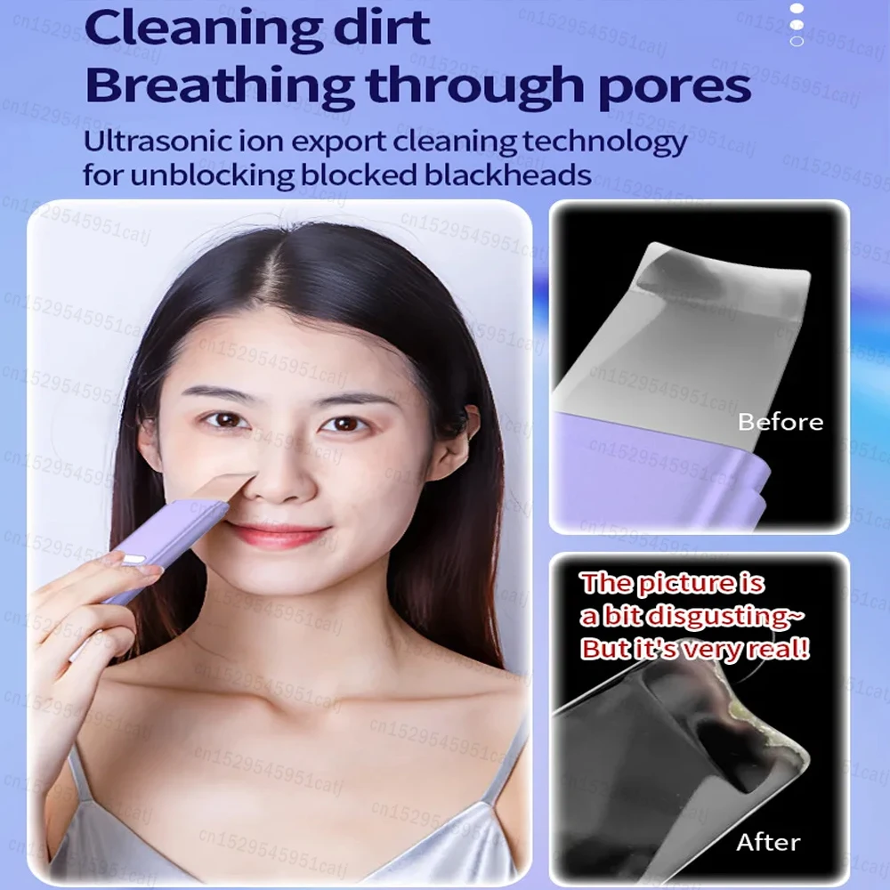 Ultrasonic Skin Scrubber Facial Spatula Blackhead Remover Deep Face Cleaning Lift Machine Peeling Shovel Pore Cleaner Face Massa