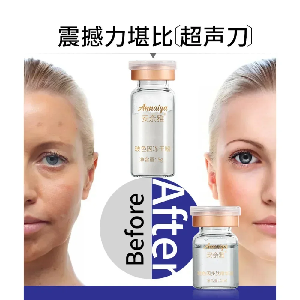 مجموعة قناع الوجه Pro-Xylane Witch مكونة من 6 أزواج من منتجات العناية بالبشرة المضادة للتجاعيد وشد البشرة وتشكيل الوجه ومضادة للشيخوخة