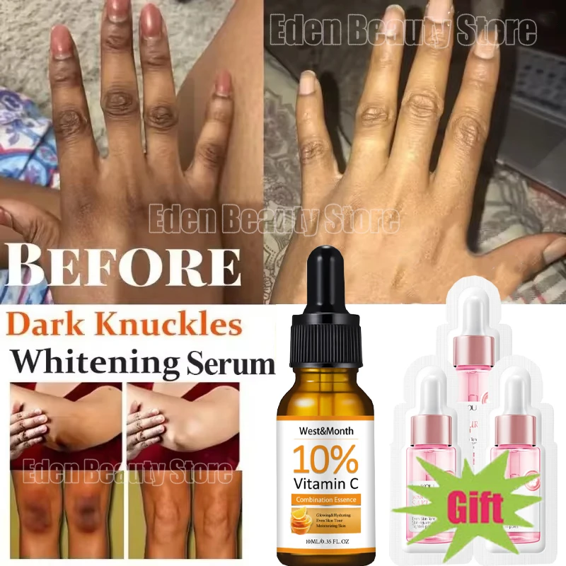 New Dark Skin Bleaching Fast Whitening Serum Quickly Lighten Stains Remover Essence Moisturizing Melanin Corrector Products