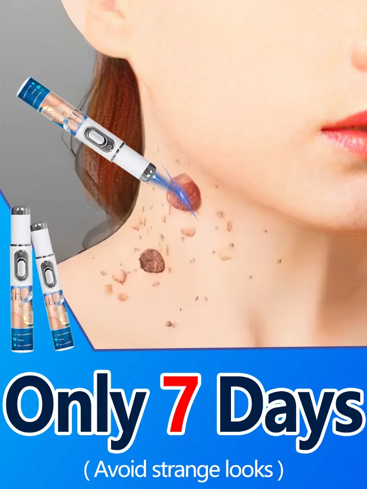 

2nd Generation solve warts tool New blu-ray pen Ion light penetration