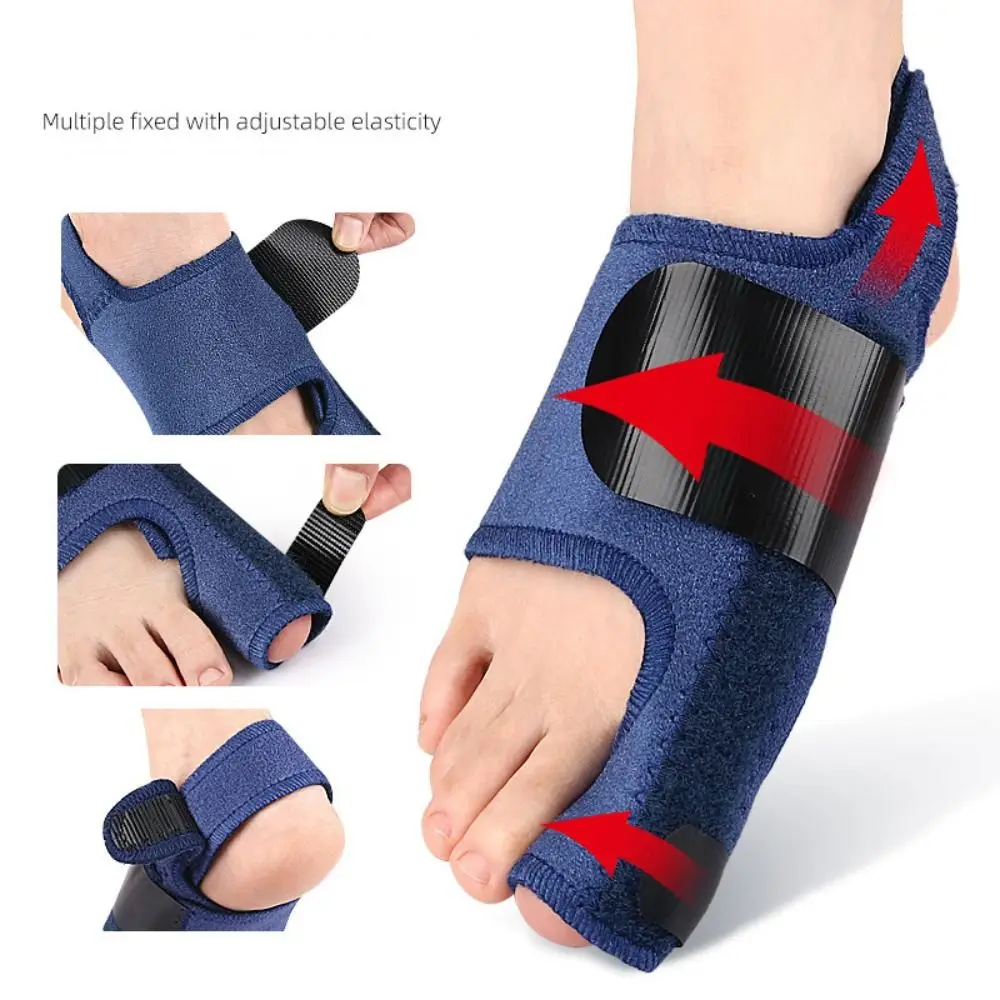 Pés valgus corrector ajustável joanete cinta protetor de joanete ferramentas de cuidados com os pés corretor de joanete cinta polegar valgus ajustador azul
