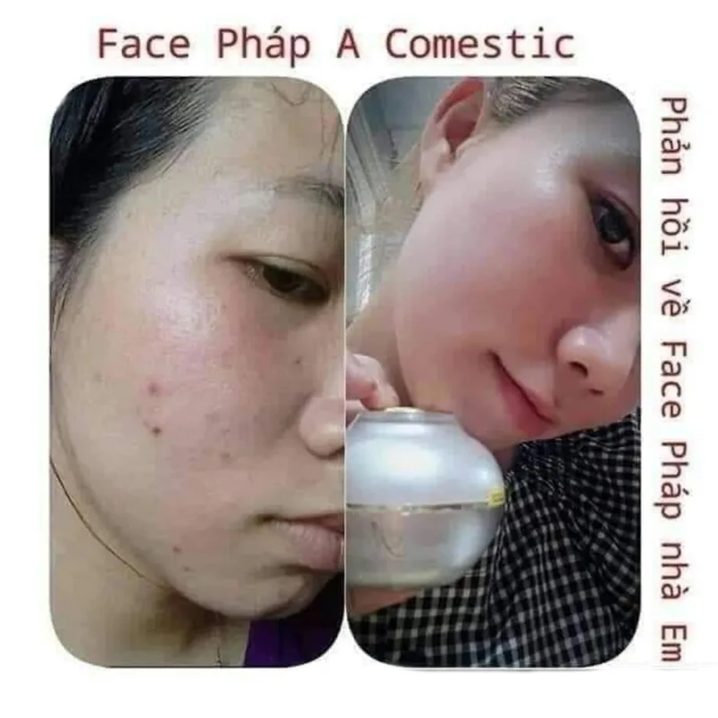 Face Pháp A COSMETICS kem dưỡng trắng da 50g remove dark skin white kem face phap tri nam tan nhang ngan ngua mun tham