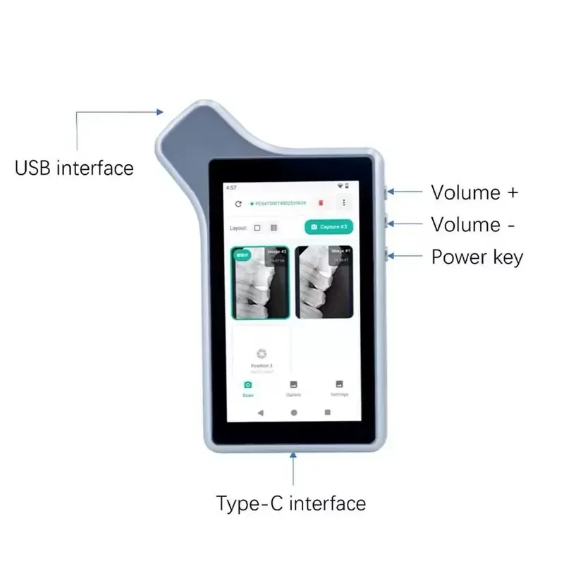 Digital Xray Imaging System Screen with Dental RVG Sensor RX
