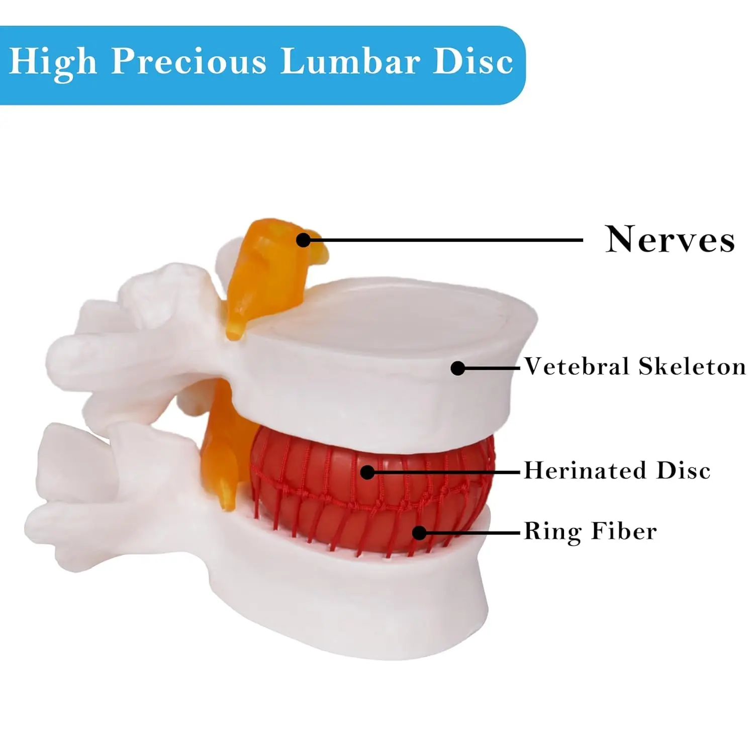 Herniated Disc Spine Model, 1.5X Life Size Lumbar Spine Anatomy Model for Teaching, Chiropractic Demonstration, Medical Learning
