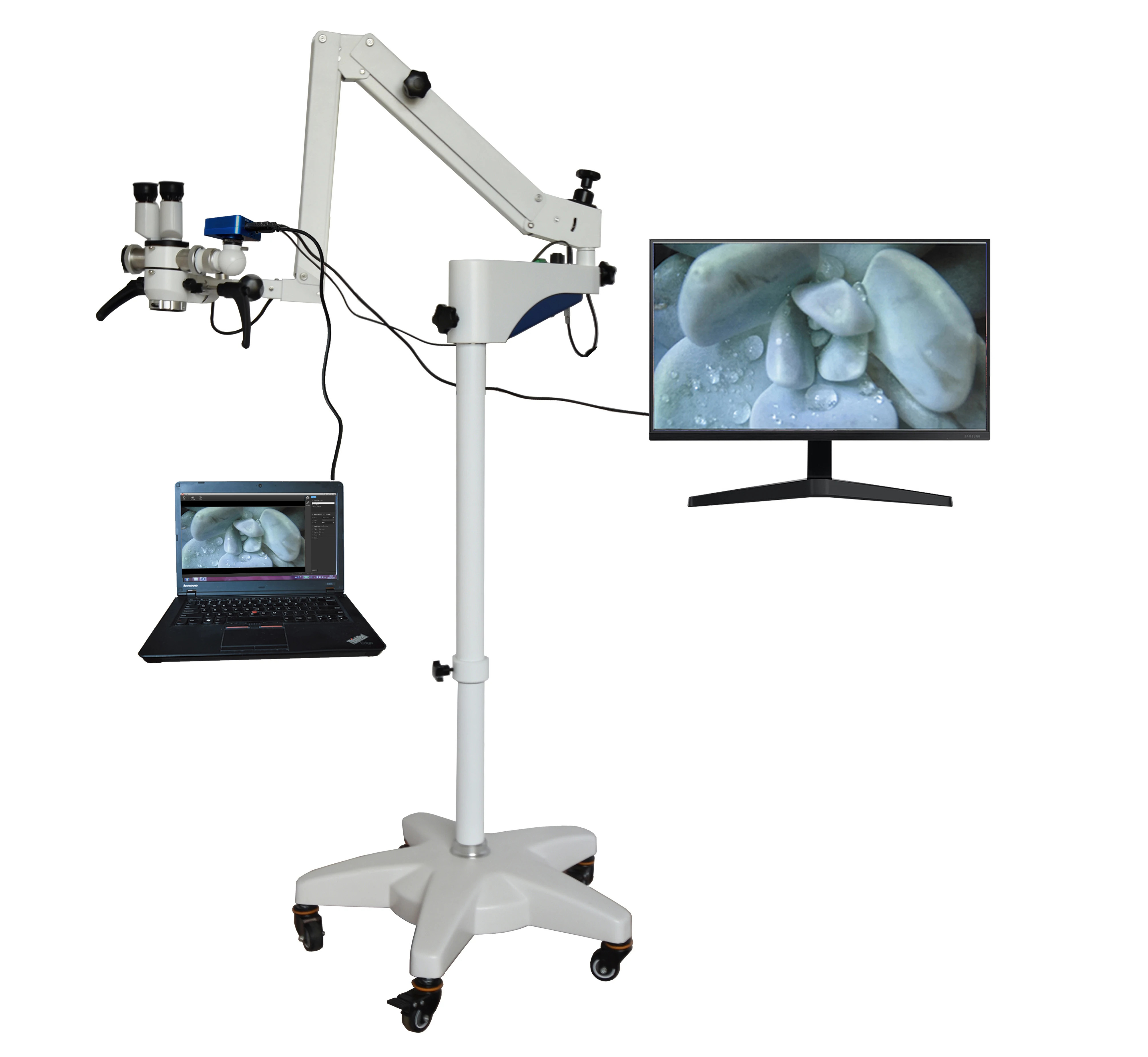 High Resolution 0-180 Degree Rotating Binocular Multifunctional Surgical Microscope