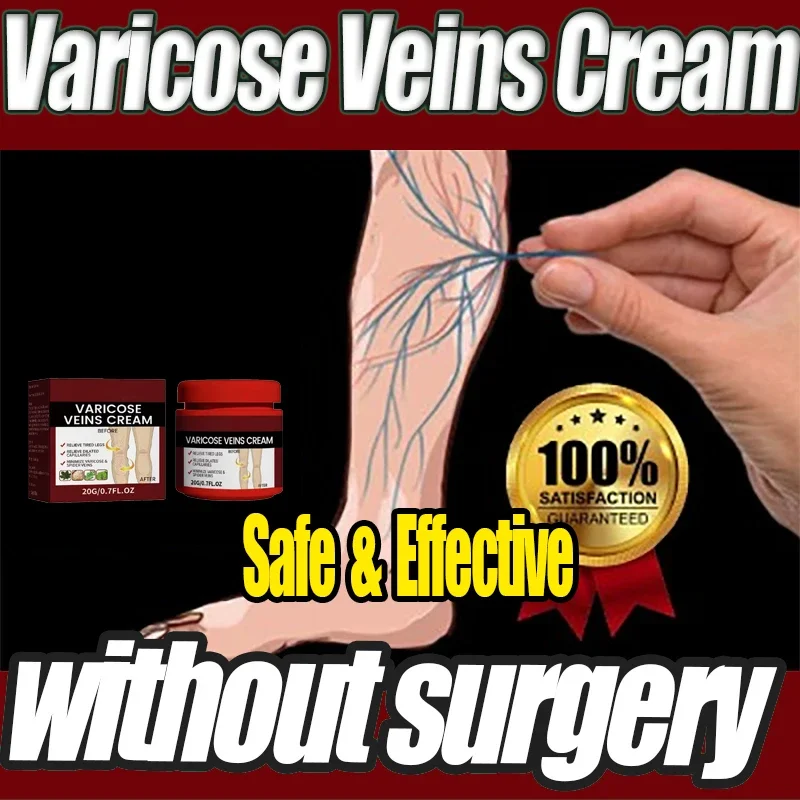 

Varicose Veins Effective Varicose Vein Relief To Relieve Vasculitis Phlebitis Spider Pain Treatment Foot Care2024