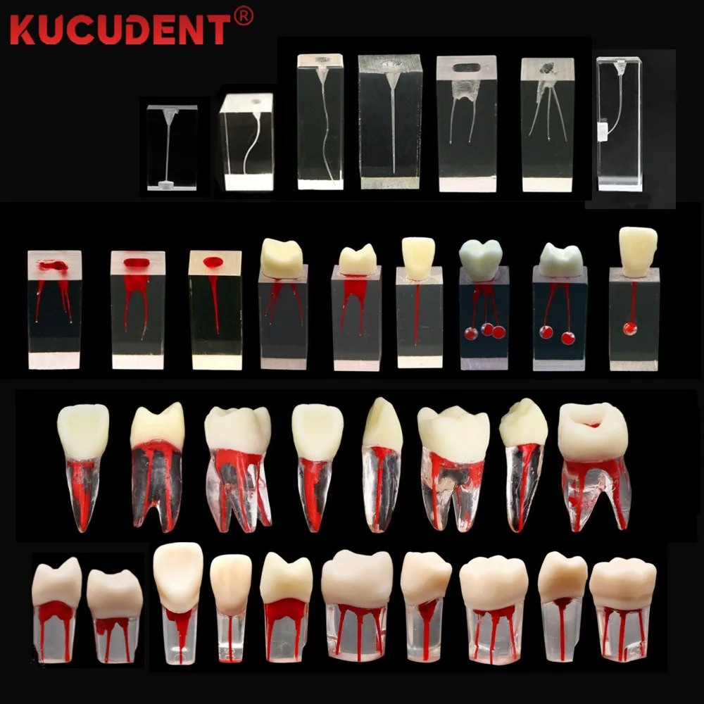 1 Buah Model Gigi Endo Gigi RCT Latihan Blok Saluran Akar Pulp Rongga Pelatihan Pengajaran Resin Gigi Endodontik Pengajaran Siswa