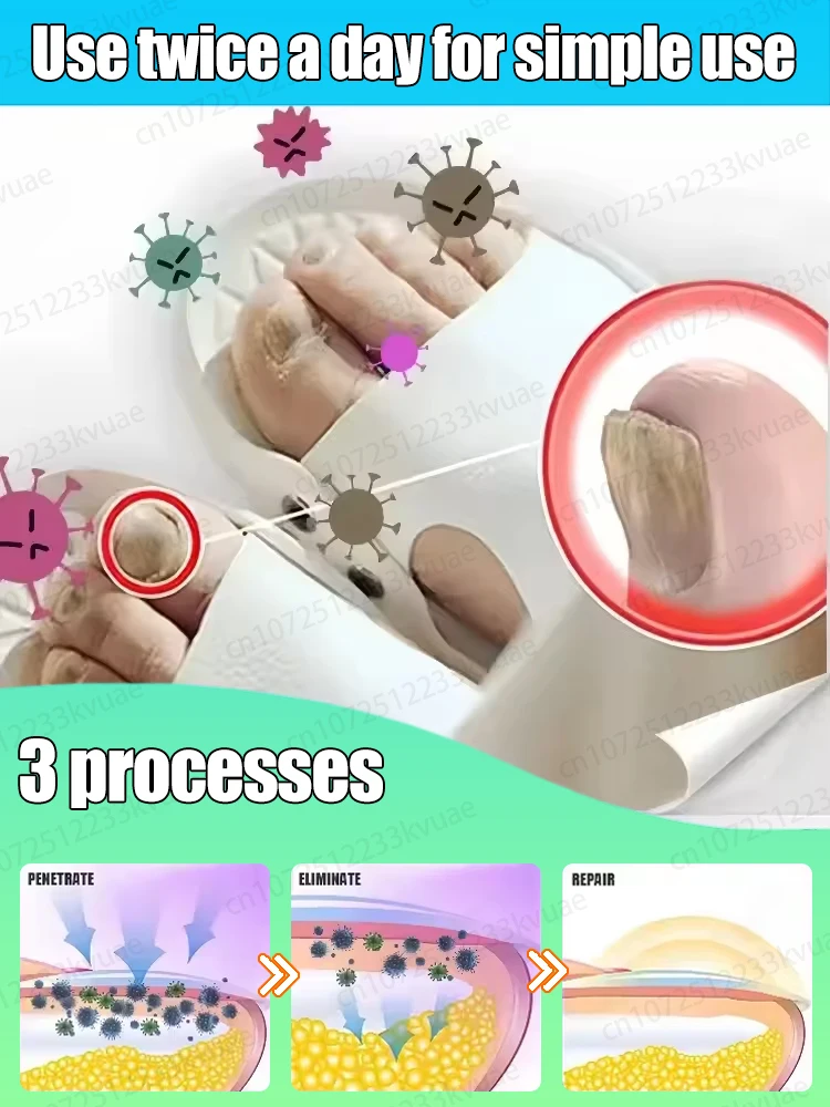 2025年ホットセール 爪真菌除去、変色、損傷した爪の修復