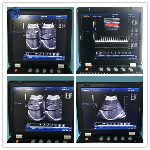 Best price laptop ultrasound machine/Hand-carried Portable 3D 4D Color Ultrasound Doppler for hospital