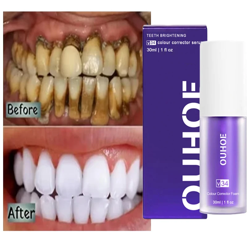 Teeth Whitening Toothpaste Serum Remove Plaque Stains Oral Hygiene Cleaning Dental Bleaching Tools Fresh Breath Tooth Care