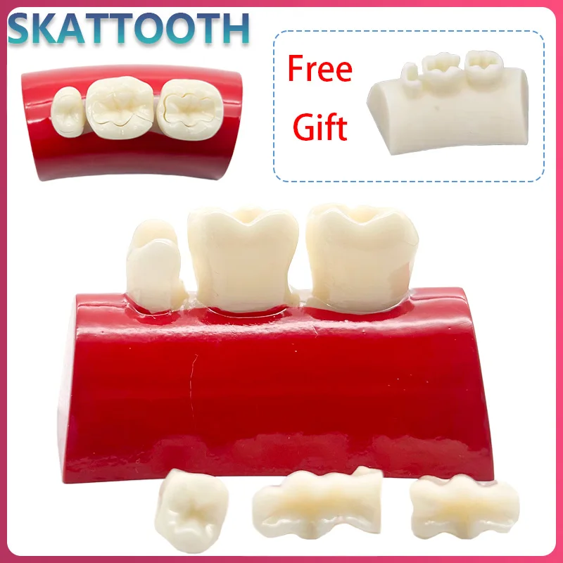 

New Dental Inlay Exercise Model Block Filling Exercise Removable Typodont Resin Materials Oral Filling Model Dentist Teaching
